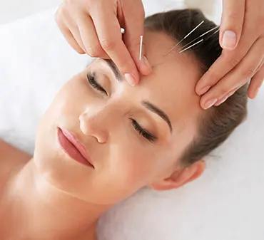 L-ACUPUNCTURE, LA STIMULATION DES POINTS DE REFLEXION